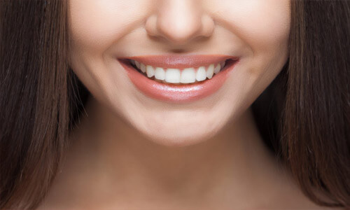 Close-up picture of a smiling woman with long brown hair and with perfect teeth showing her happiness with the dental bridge she received at Premier Holistic Dental in Costa Rica.
