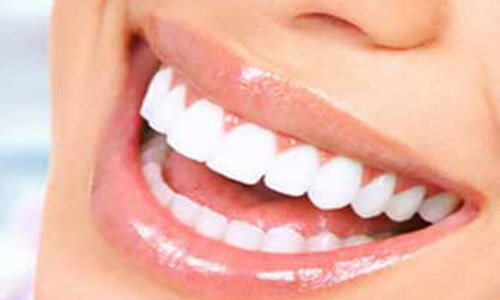 Close-up picture of a smiling woman with perfect teeth, happy with her Holistic dental filling procedure she had at Premier Holistic Dental in Costa Rica.